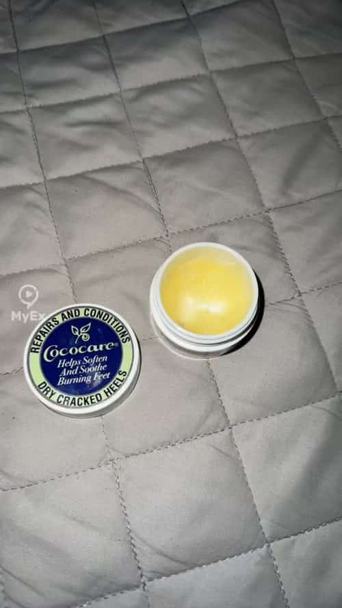 My experience with Cococare cream for treating cracked heels - image on MyEx