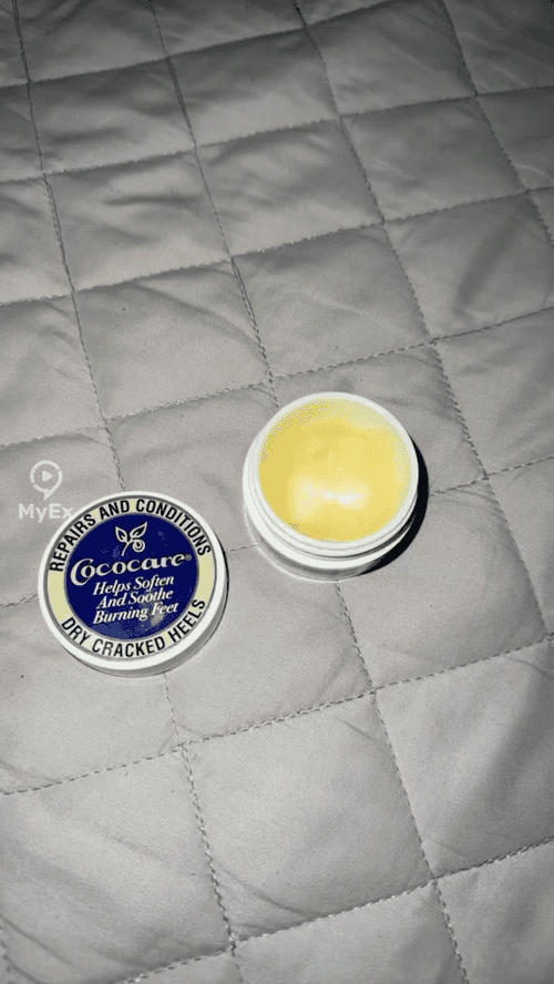 Ang Aking Karanasan sa Cococare Cream para sa Paggamot ng Cracked Heels - image on MyEx